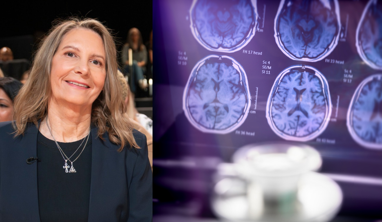 Rhonda Voskuhl, MD and brain scans.